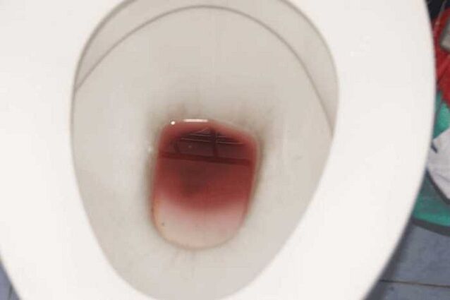 spotting i fir nuair excited